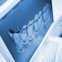 Ceramic Dental Implant Process